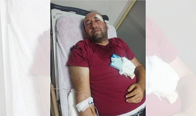 Viranşehir'de gazeteciye darp ve tehdit: Belediyeyle ilgili bir şey yazarsan ölürsün